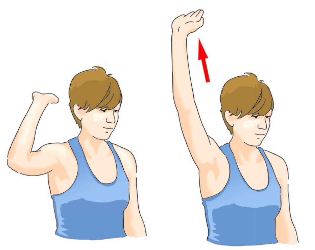 El fastidioso y recurrente problema del adormecimiento de manos detalle 4
