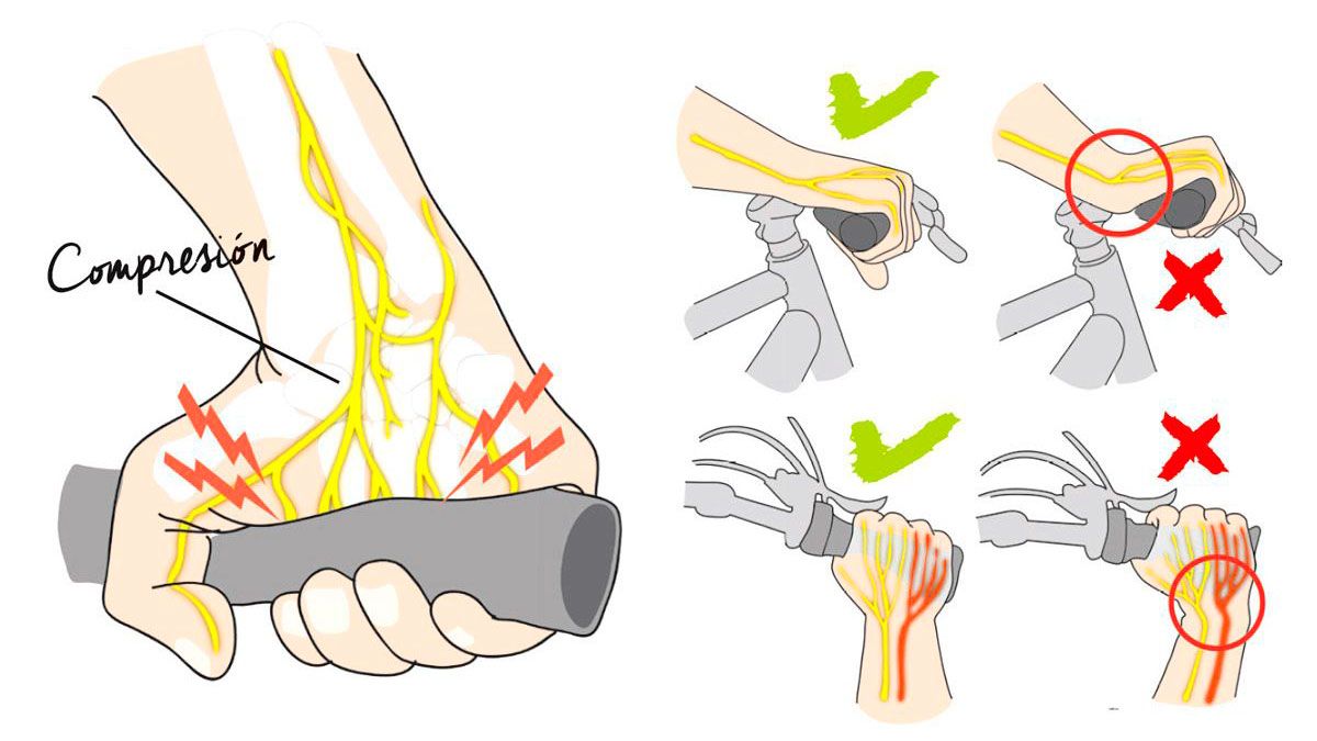 El fastidioso y recurrente problema del adormecimiento de manos