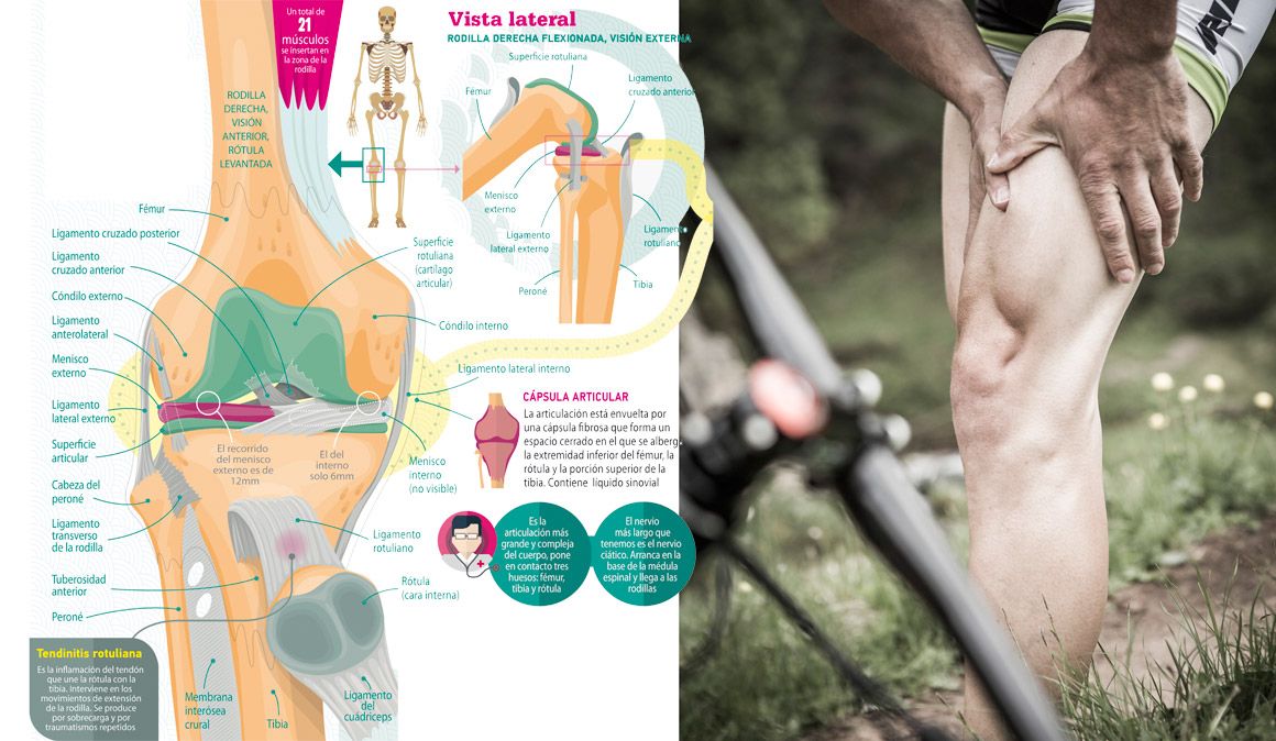 Las rodillas ¿Por qué nos lesionamos?
