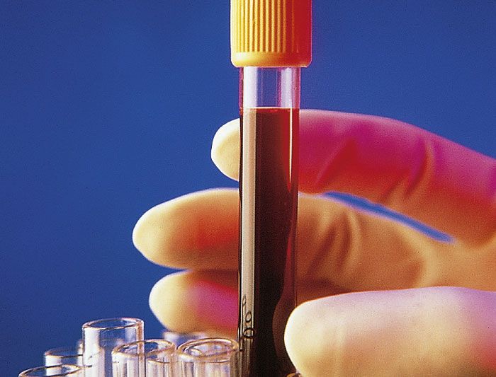 ¿Qué hay en mi sangre?