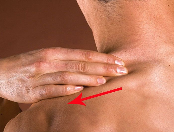 ANTES DE MONTAR:CUELLO
