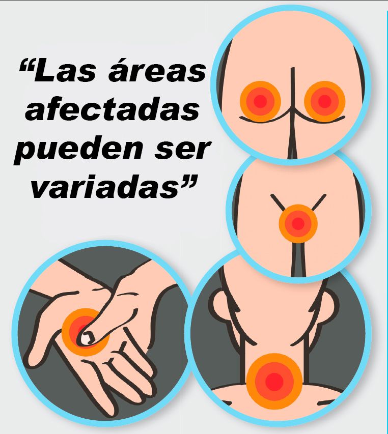 Las quejas más comunes Las quejas más comunes