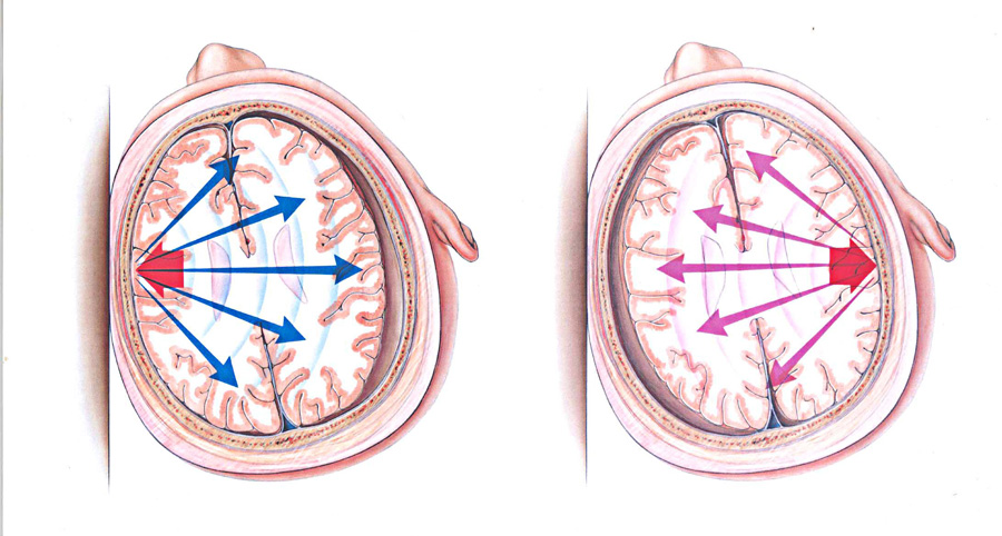 Cascos con MIPS ¿Qué ventajas tienen?